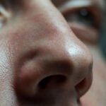 Burun Estetiği Riskleri