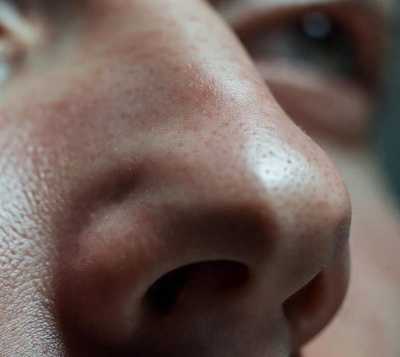 Burun Estetiği Riskleri