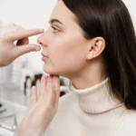 burun estetiği öncesi